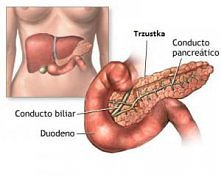 Zapalenie trzustki, a jej schorzenia