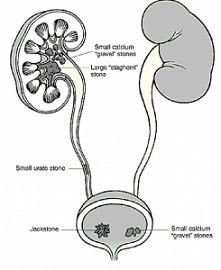 Choroby nerek i ich leczenie