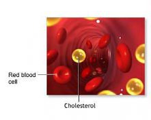 Cholesterol a dieta