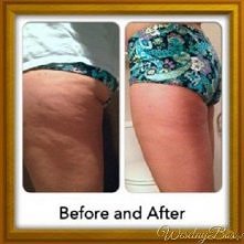 Domowe sposoby na pozbycie ...