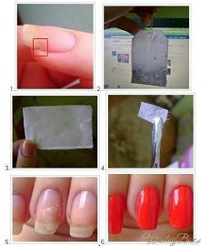 sposób na pęknięty paznokieć