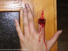 "Skinned Finger" ...