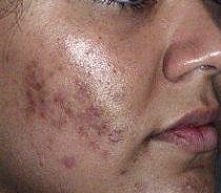 5 prostych sposobów, aby us...