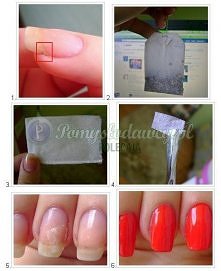 ratunek dla złamanego pazno...