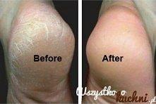 na ładne piętki :)