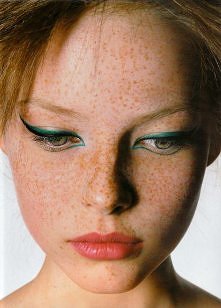 #freckles