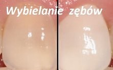 Domowy i sprawdzony sposób ...