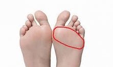 Odparzenia na stopach
Źle d...