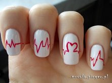 Ekg ^.^