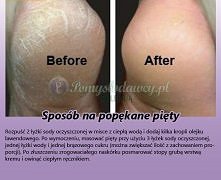 Sposób na popękane pięty