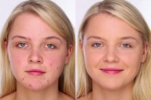 Jak naturalnie zakamuflowac trądzik?

Makijaż BEZ grubej warstwy