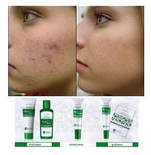 ładnie się jej zagoiło.. Master herb.Stosuje.. Najlepsze:)