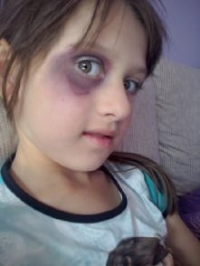 cz.2 próby zrobienia rany