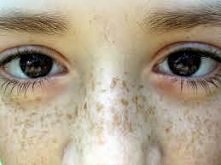 co na przebarwienia na twar...