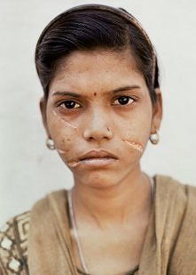 Mąż tej młodej dziewczyny pociął jej twarz żyletką.

Kurde... nie wiem co powiedzieć. Okropne :\