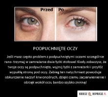 podpuchniete oczy