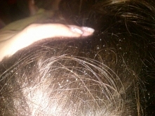 Jeśli nie wiesz jak sobie poradzić z łupieżem zapraszam do lektury mojego posta, który wyświetli się po kliknięciu w zdjęcie.