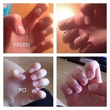 Przed i po kuracji z odżywką eveline 8w1. Plusy: mocne,twarde paznokcie. Nie łamią się. Mniej rozdwajania,praktycznie w ogóle. Szybko rosną. Minusy: strasznie niszczy naskorki w...