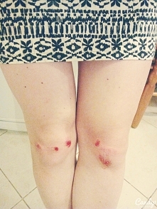 Macie sposób na zdarte kola...