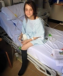 Nastolatka od 7 roku życia marzyła, by amputowano jej nogę. W końcu jej marzenie się spełniło.