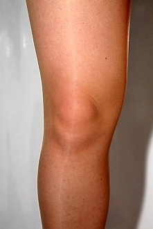 witam czy wy też borykacie się z problebami ,ze stawami ? Ja poprzez ćwczenia dostałam uszkodzenie chrząstki kolanowej i juz od 2 tyg nie cicze bo czuję bóle w kolanach.