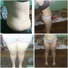 Moje małe efekty ,ale nie poddaje się i idę dalej (około 3,5 msc z kilkudniowymi przerwami ) 
P.S Proszę bez hejtu ,to przyciemnienie na udach to choroba skóry ;P