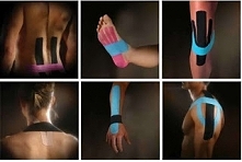 Trochę o kinesiotapingu na blogu. (klik w zdjęcie)