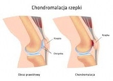 Koniecznie zobacz bo może to też tyczyć się Ciebie :) (kilk w zdjęcie)