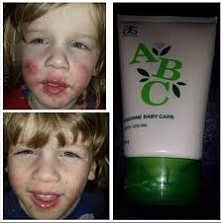 Ziołowy krem przeciw odparz...