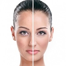 Podkrążone, opuchnięte oczy. Znacie jakieś dobre sposoby, kosmetyki które by pomogły?