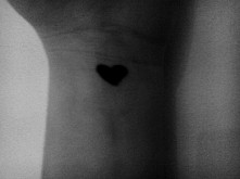 „chroń serce, a reszta sama się obroni"