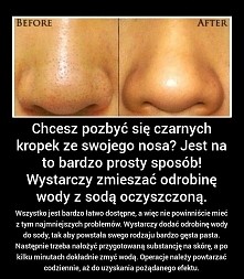 Czarne kropki na nosie