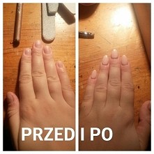 metamorfoza paznokci