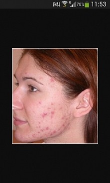 Zdjęcie z internetu, ale mam bardzo podobne... Proszę pomóżcie mi