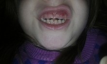 To zęby mojej kuzynki.... w...