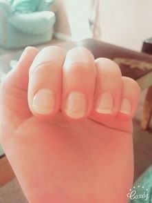 1.5 miesiaca stosowania odz...