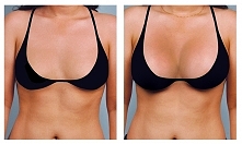 Sprawdzone sposoby na powiększenie i ujędrnienie biustu -> biustowo.blogspot.com/
Bez niebezpiecznych implantów i nie działających tabletek.