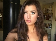 Jej odmienność przyniosła jej sławę. Została docenianą modelką!