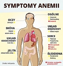 symptomy anemi