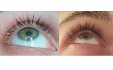 Serum, dzięki któremu ma dłuższe rzęsy!