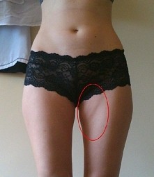 znacie jakies dobre cwiczena na to? o.o help!!!!!!! (zdj z neta) pomóżcie prosze!