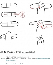 Plastry opatrunkowe zsuwają...