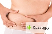 Czym są rozstępy, jak powstają i jak im przeciwdziałać? Kilka odpowiedzi