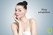 Olej z czarnuszki z blizny potrądzikowe