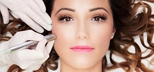 dermabrazja - głęboki peeling mechaniczny