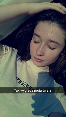 Co mi poradzicie zrobi z tym na twarzy? chyba jem coś czego nie powinnam i mało rzeczy mi pomaga na to. wyciskanie powoduje u mnie blizny. dostałam wiele porad i nie wiem jak się odwdzięczyć aż mnie zatkało