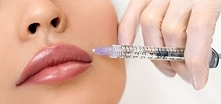 Kwas hialuronowy a powiększanie ust
