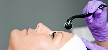 Derma - roller jakie przynosi efekty