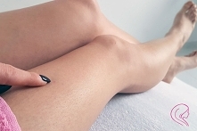 Wrastające włoski - jak skutecznie z nimi walczyć?