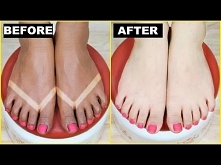 How To Remove SunTan (Effective + Instant) - Skin Brightening | Anaysa